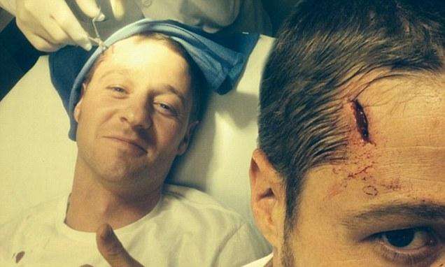 ben-mckenzie-spent-his-birthday-in-an-er-after-getting-injured-on-set-photo-u1