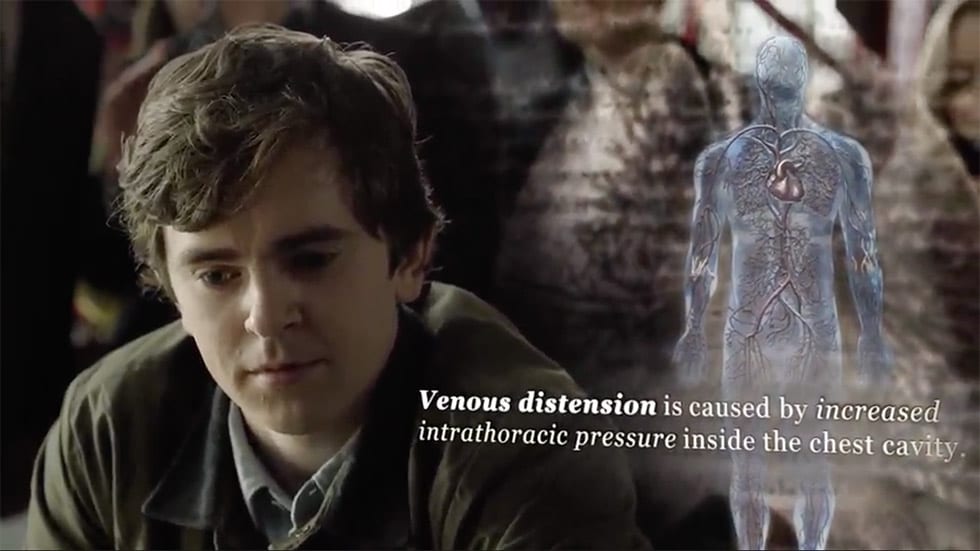 thegooddoctor-s01e01a